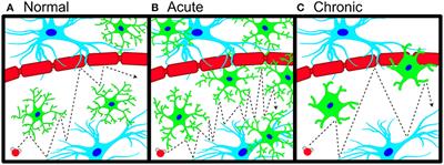 Detecting Microglial Density With Quantitative Multi-Compartment Diffusion MRI